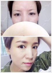-FUMEIHUI·科技美肤·美体SPA