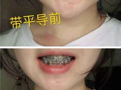 -团圆口腔·种植中心(锦江院区)