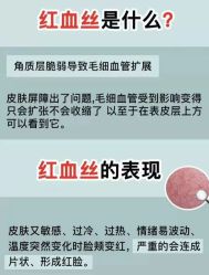 -凡碧诗毛孔清洁收细