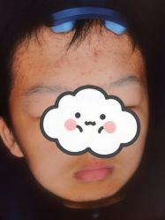 体验前-苏州卫康美容医院