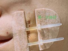 -杭州市第三人民医院