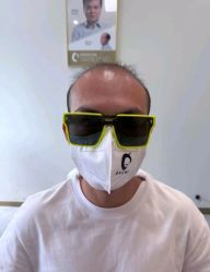 -唐风采假发补发定制