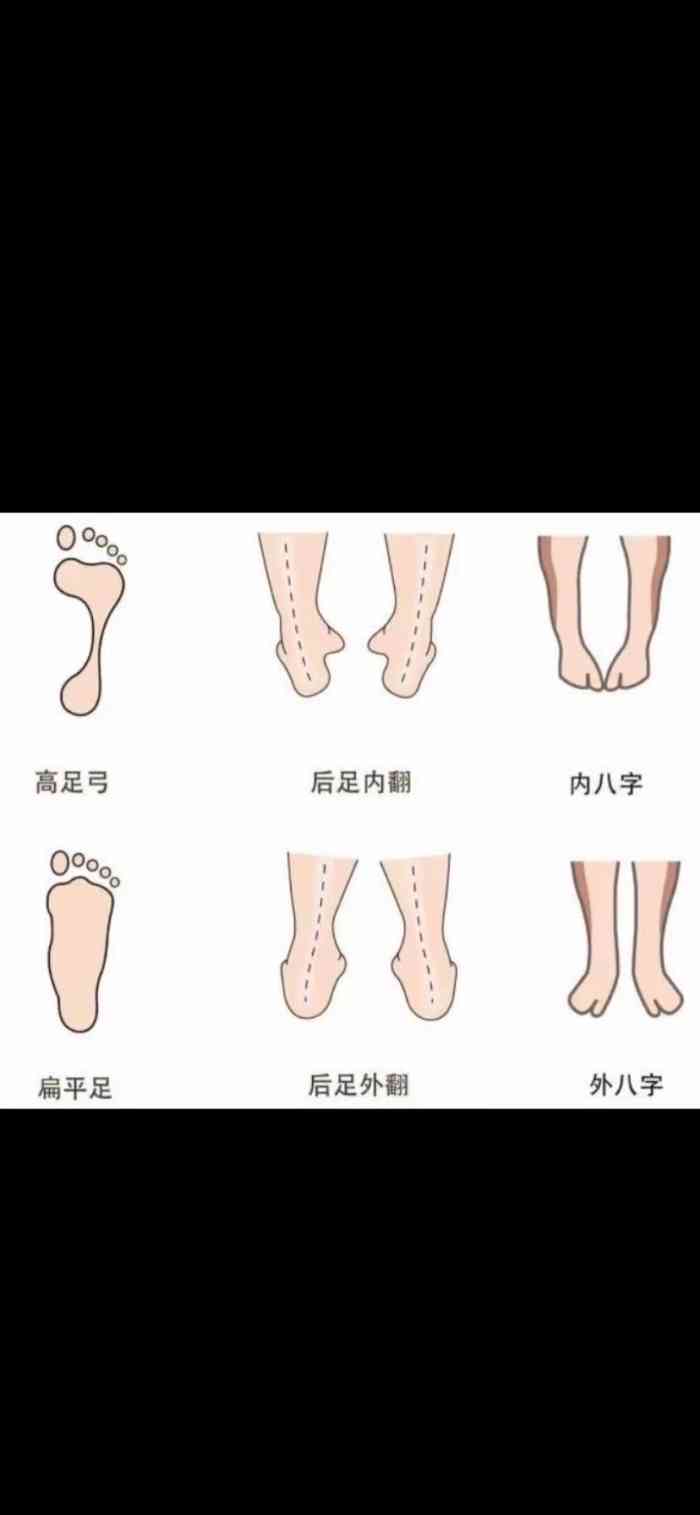 双鱼线健身fitness(奥体店)-"感谢dp抽中刚开始健身的我～抽中霸王餐.