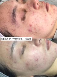 -MLP美丽派·问题肌疗愈中心