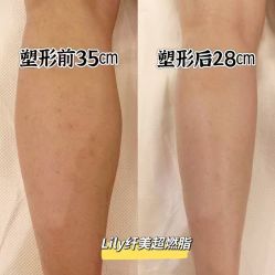 -Lily纤美·科技减脂中心