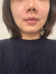 -海涛医疗美容·面部抗衰·注射美鼻