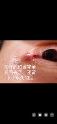 体验后-八大处整形