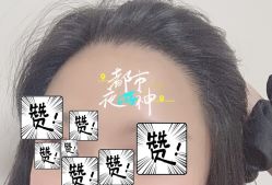 -大麦微针植发全国连锁