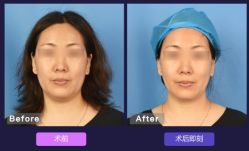 -上海漾颜医疗美容