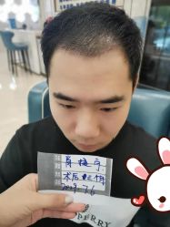点击看大图 -大麦微针植发丨全国连锁
