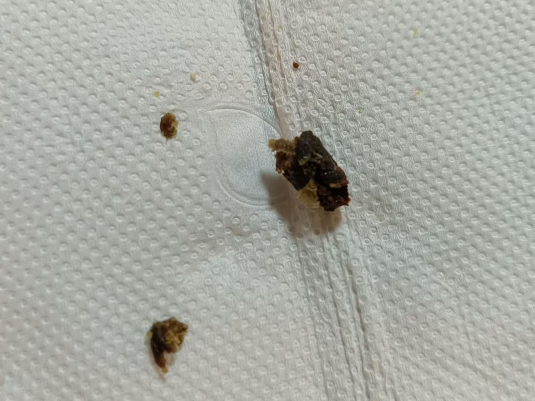 爱护耳朵从我做起