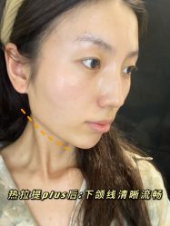 -西安壹加壹医疗美容·西北抗衰旗舰店
