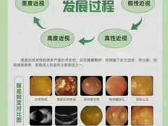 -宝视达眼镜(周口市广场店)