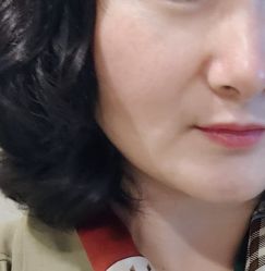 体验前-苏州奥拉克美容医院