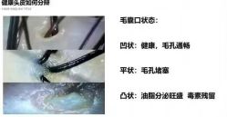 -诗碧曼养发