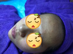 -资医堂专业袪痘袪斑