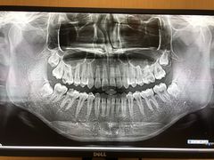 -同步齿科·数字化正畸种植口腔中心(珠海店)