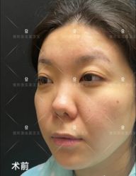 -北京米扬丽格医疗美容·联合丽格鼻整形中心