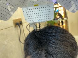 -碧莲盛·不剃发植发