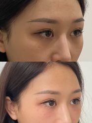 -Yestar重庆艺星医疗美容医院