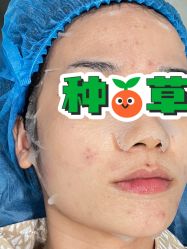 -美瑞莎创美医疗美容