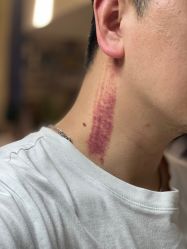 -清颜堂专业祛痘