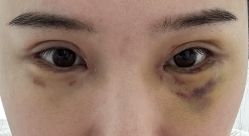 -成都艾特他整形外科医院