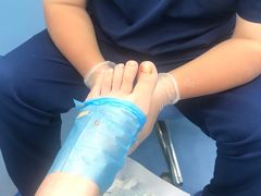 -Andrew指甲专科灰指甲·甲沟炎矫正·3D步态矫形鞋垫定制(浦三路店)