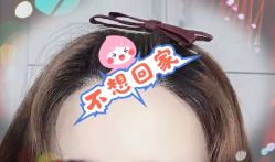 -大麦微针植发全国连锁