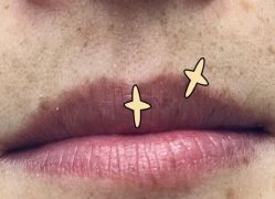 点击看大图 -铂特丽医美·眼鼻整形·光电美肤·注射抗衰