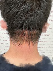 点击看大图 -熙朵美学植发·连锁品牌