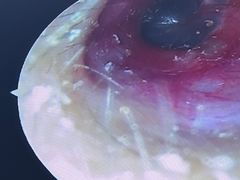 -溥耳·可视采耳·头疗·沐眼