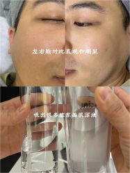 -VE小颜皮肤管理&科学美肤中心