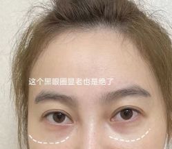 -南京健丽·去眼袋医疗美容机构