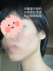 体验后-深圳广和门诊部·整形医疗美容