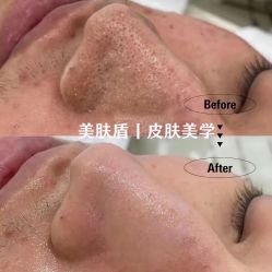 -美肤盾祛痘·问题肌头疗管理中心