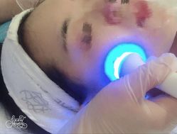 -紫御国际抗衰ZOE ANTI AGING