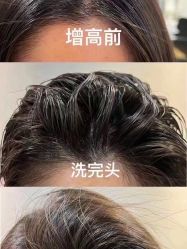 -MI HAIR