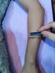 -薇兰专业脱毛连锁机构