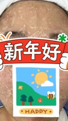 体验前-小忠丽格医美