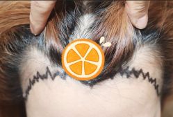 -大麦微针植发全国连锁