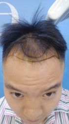 -雍禾植发全国连锁