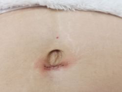 -成都军建医院·疤痕诊疗中心