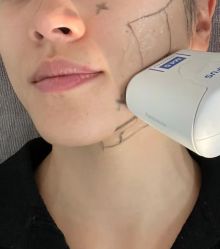 -广州美莱医疗美容医院