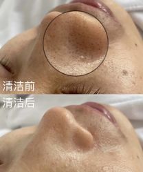 -SKIN79皮肤管理中心