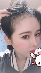 -大麦微针植发丨全国连锁