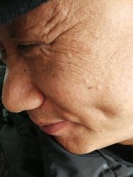 -痣清宫祛斑祛痣连锁店