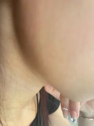 -美瑞莎创美医疗美容