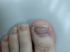 -新甲连锁灰指甲·甲沟炎·鸡眼(黑龙江路店)