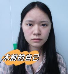 -素美医疗美容·西南眼鼻整形·修复基地